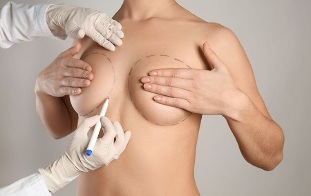 metody zvětšení prsou chirurgickým zákrokem