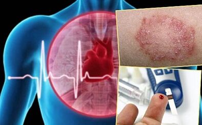 Kontraindikace pro lipolifting